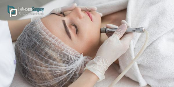 Is Dermabrasion Considered Plastic Surgery?